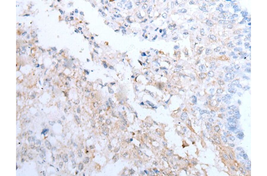 CLEC14A Antibody from Signalway Antibody (43651) - Antibodies.com