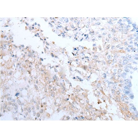 CLEC14A Antibody from Signalway Antibody (43651) - Antibodies.com