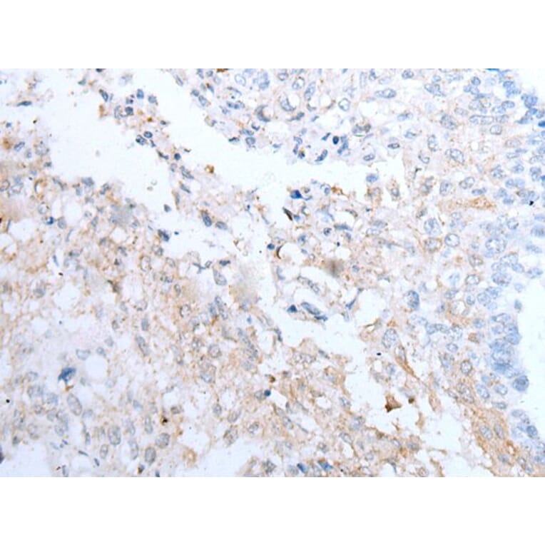 CLEC14A Antibody from Signalway Antibody (43651) - Antibodies.com