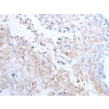 CLEC14A Antibody from Signalway Antibody (43651) - Antibodies.com