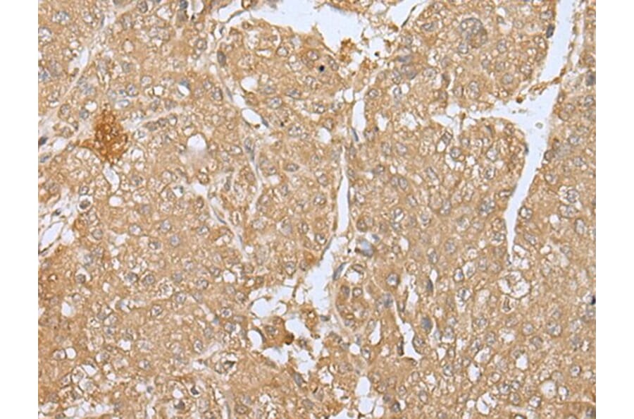 SMARCA1 Antibody from Signalway Antibody (43663) - Antibodies.com