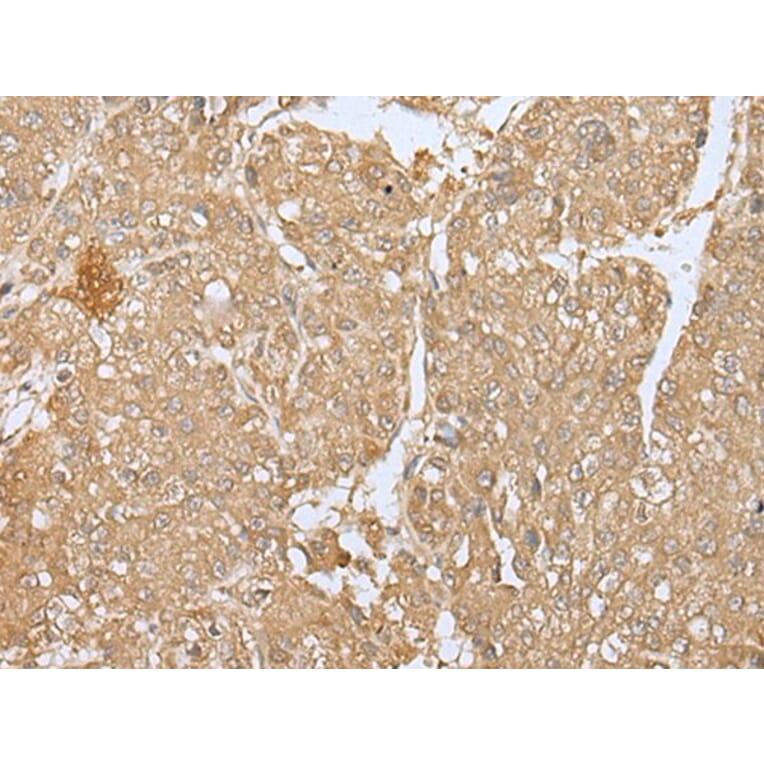SMARCA1 Antibody from Signalway Antibody (43663) - Antibodies.com