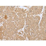 SMARCA1 Antibody from Signalway Antibody (43663) - Antibodies.com