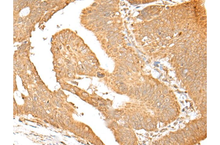 SMARCA1 Antibody from Signalway Antibody (43663) - Antibodies.com