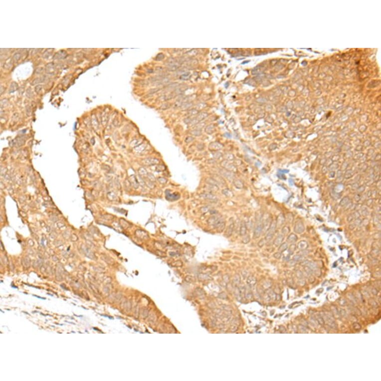 SMARCA1 Antibody from Signalway Antibody (43663) - Antibodies.com