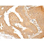 SMARCA1 Antibody from Signalway Antibody (43663) - Antibodies.com