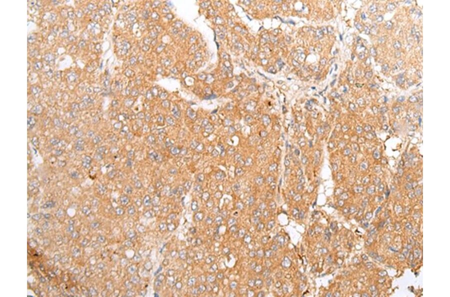 TMEM107 Antibody from Signalway Antibody (43666) - Antibodies.com