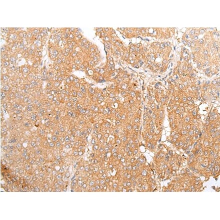 TMEM107 Antibody from Signalway Antibody (43666) - Antibodies.com