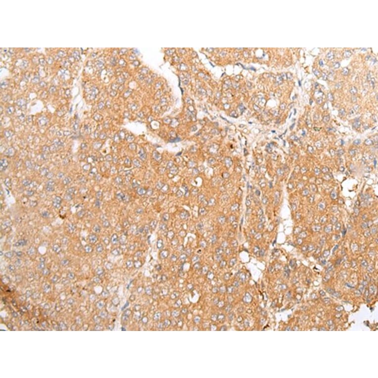 TMEM107 Antibody from Signalway Antibody (43666) - Antibodies.com