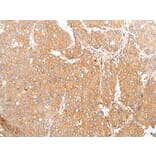 TMEM107 Antibody from Signalway Antibody (43666) - Antibodies.com