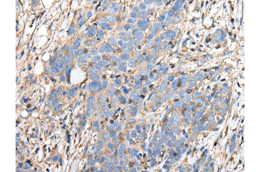 PLA2G16 Antibody from Signalway Antibody (43690) - Antibodies.com