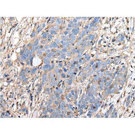 PLA2G16 Antibody from Signalway Antibody (43690) - Antibodies.com
