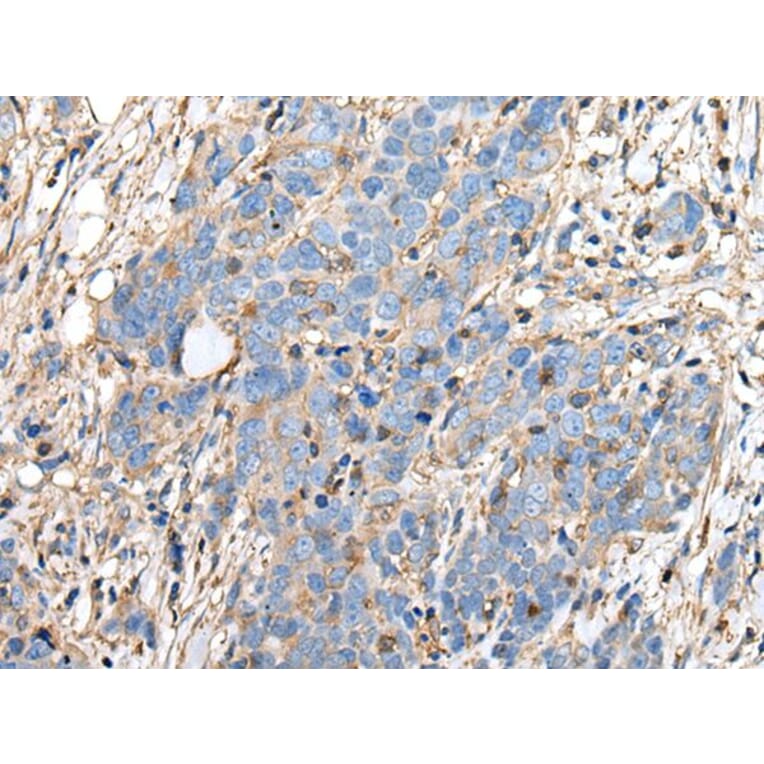 PLA2G16 Antibody from Signalway Antibody (43690) - Antibodies.com