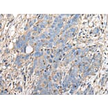 PLA2G16 Antibody from Signalway Antibody (43690) - Antibodies.com