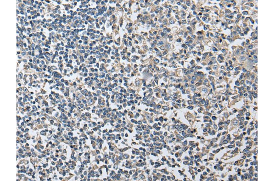 PLA2G16 Antibody from Signalway Antibody (43690) - Antibodies.com