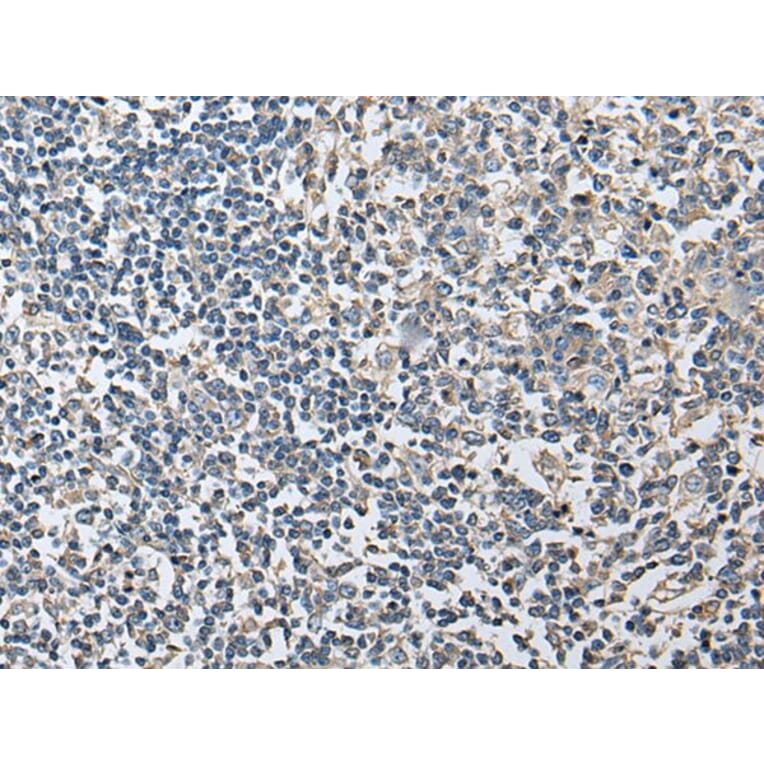 PLA2G16 Antibody from Signalway Antibody (43690) - Antibodies.com
