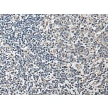 PLA2G16 Antibody from Signalway Antibody (43690) - Antibodies.com