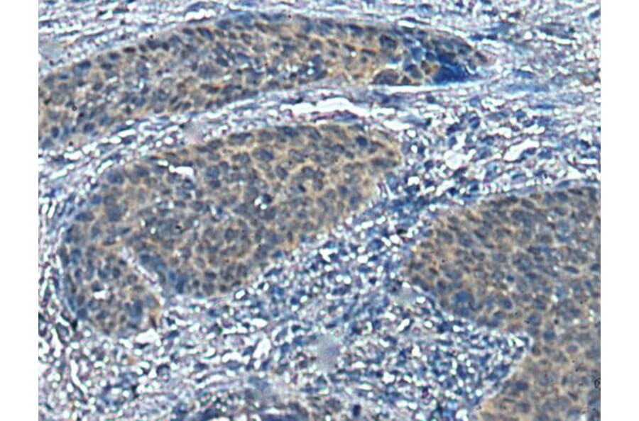 SLC16A6 Antibody from Signalway Antibody (43695) - Antibodies.com