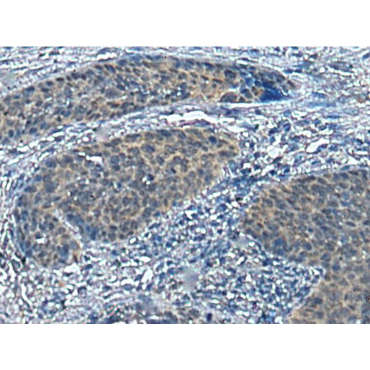 SLC16A6 Antibody from Signalway Antibody (43695) - Antibodies.com