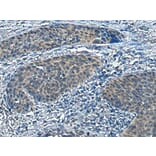 SLC16A6 Antibody from Signalway Antibody (43695) - Antibodies.com