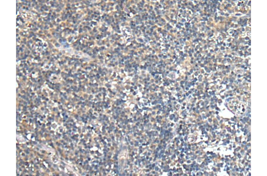 SLC16A6 Antibody from Signalway Antibody (43695) - Antibodies.com