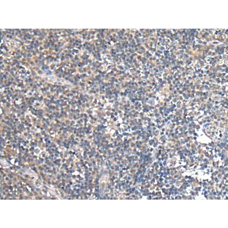 SLC16A6 Antibody from Signalway Antibody (43695) - Antibodies.com