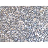 SLC16A6 Antibody from Signalway Antibody (43695) - Antibodies.com