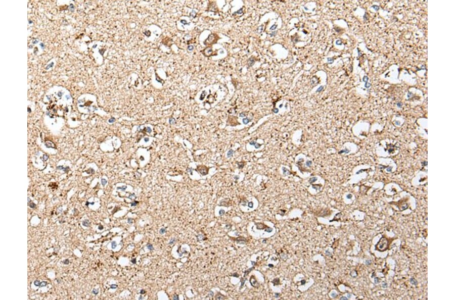 SLC12A3 Antibody from Signalway Antibody (43712) - Antibodies.com