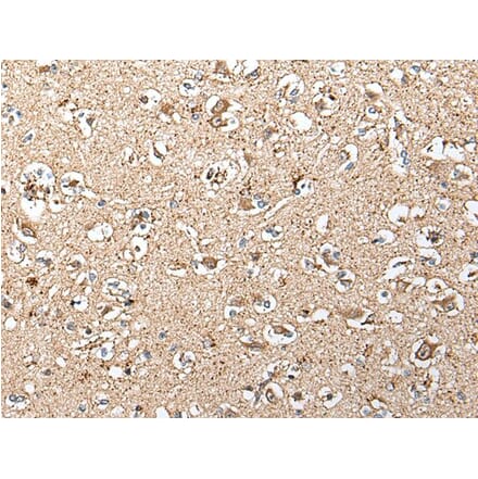 SLC12A3 Antibody from Signalway Antibody (43712) - Antibodies.com