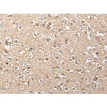 SLC12A3 Antibody from Signalway Antibody (43712) - Antibodies.com