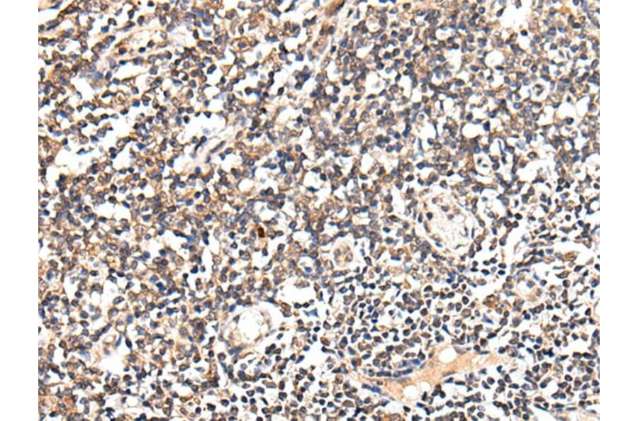 SLC12A3 Antibody from Signalway Antibody (43712) - Antibodies.com