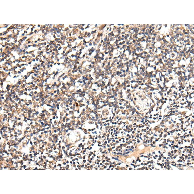 SLC12A3 Antibody from Signalway Antibody (43712) - Antibodies.com