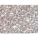 SLC12A3 Antibody from Signalway Antibody (43712) - Antibodies.com