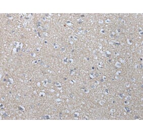 MAGEB1 Antibody from Signalway Antibody (43746) - Antibodies.com