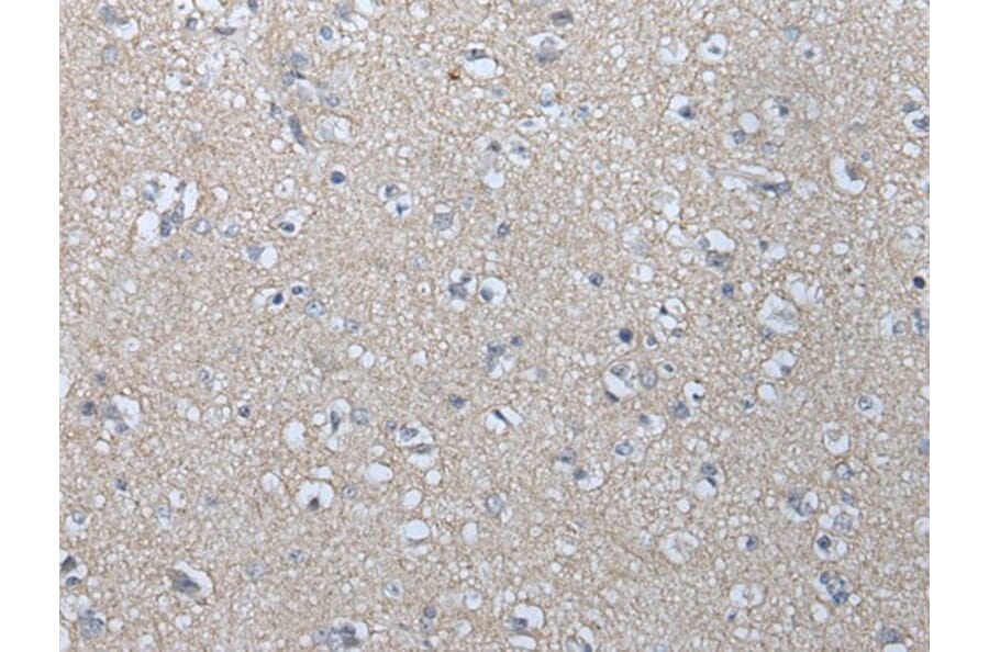 MAGEB1 Antibody from Signalway Antibody (43746) - Antibodies.com