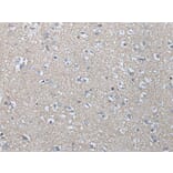 MAGEB1 Antibody from Signalway Antibody (43746) - Antibodies.com