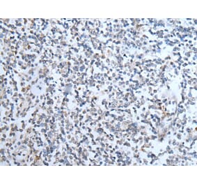 TMPRSS6 Antibody from Signalway Antibody (43747) - Antibodies.com