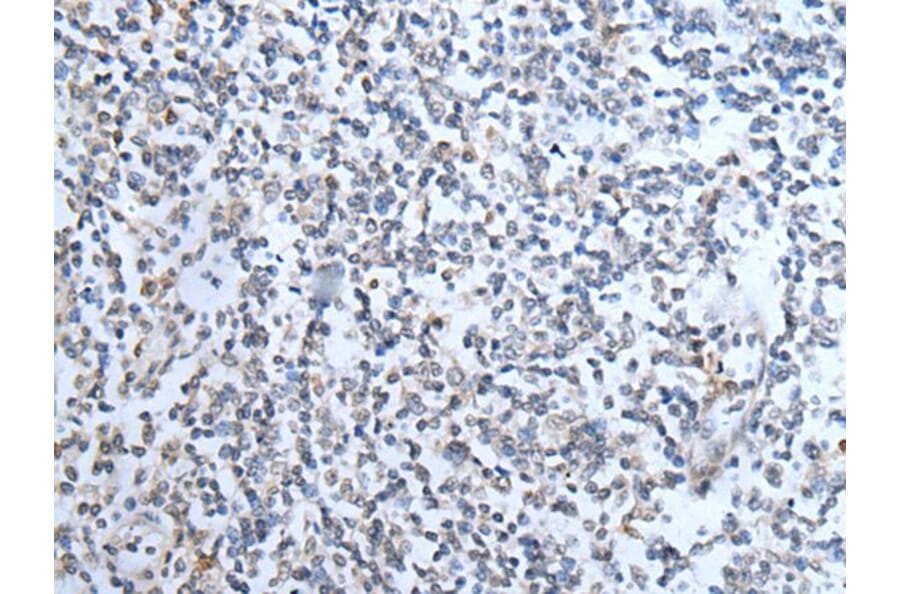 TMPRSS6 Antibody from Signalway Antibody (43747) - Antibodies.com