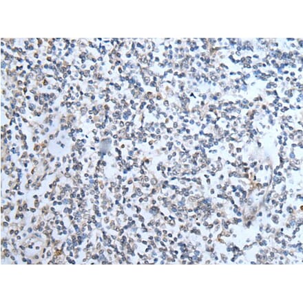 TMPRSS6 Antibody from Signalway Antibody (43747) - Antibodies.com