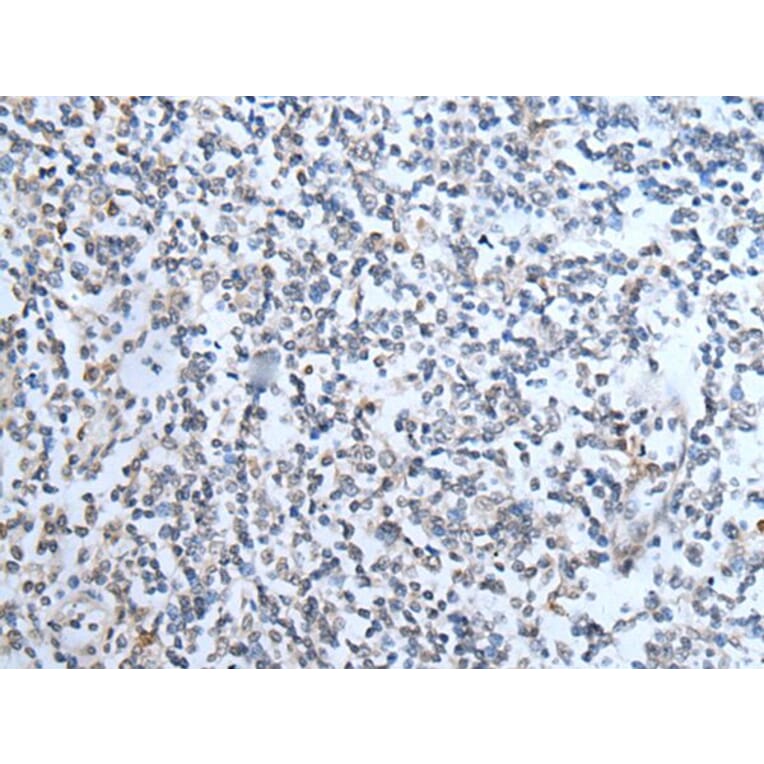 TMPRSS6 Antibody from Signalway Antibody (43747) - Antibodies.com