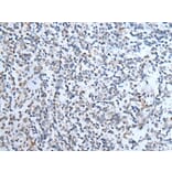 TMPRSS6 Antibody from Signalway Antibody (43747) - Antibodies.com