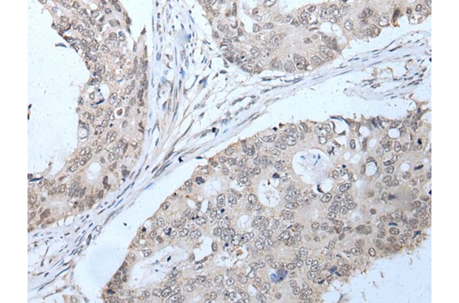 PPP1R42 Antibody from Signalway Antibody (43749) - Antibodies.com