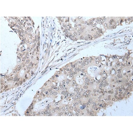 PPP1R42 Antibody from Signalway Antibody (43749) - Antibodies.com