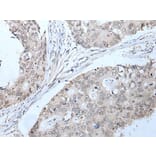 PPP1R42 Antibody from Signalway Antibody (43749) - Antibodies.com