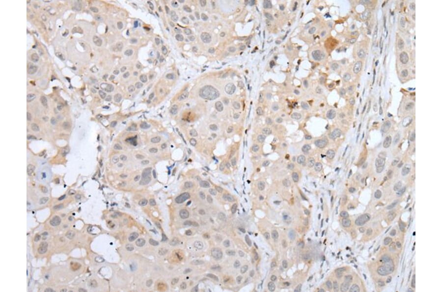 MEF2BNB Antibody from Signalway Antibody (43753) - Antibodies.com