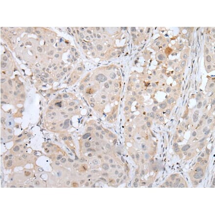 MEF2BNB Antibody from Signalway Antibody (43753) - Antibodies.com