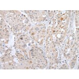 MEF2BNB Antibody from Signalway Antibody (43753) - Antibodies.com