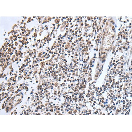 ADAMTS7 Antibody from Signalway Antibody (43760) - Antibodies.com