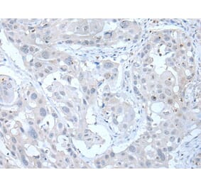ANGPTL6 Antibody from Signalway Antibody (43761) - Antibodies.com