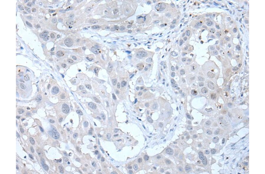 ANGPTL6 Antibody from Signalway Antibody (43761) - Antibodies.com